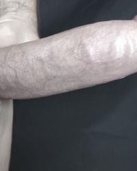 photo-thumb