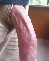 photo-thumb