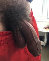 photo-thumb