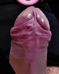 photo-thumb