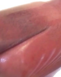 photo-thumb
