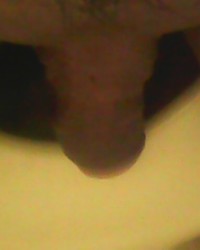 photo-thumb
