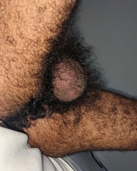 photo-thumb