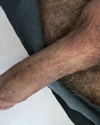 photo-thumb