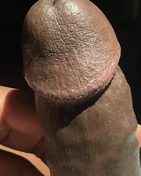 photo-thumb
