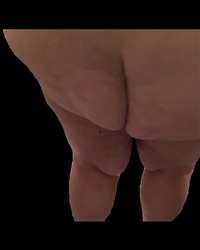 photo-thumb