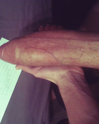 photo-thumb