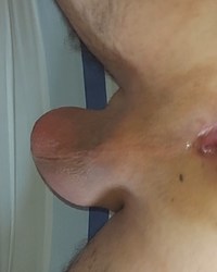 photo-thumb