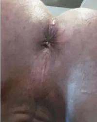 photo-thumb