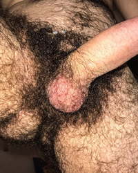 photo-thumb