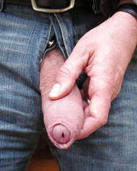 photo-thumb