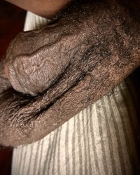 photo-thumb