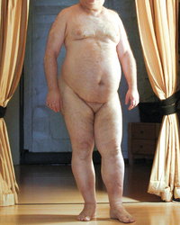 photo-thumb