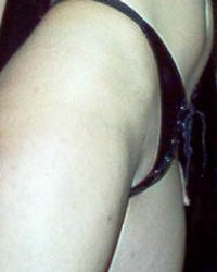 photo-thumb