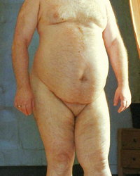 photo-thumb