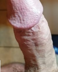 photo-thumb