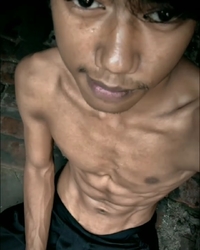 photo-thumb
