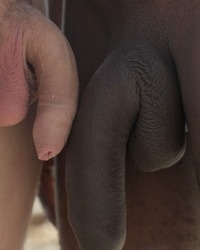 photo-thumb