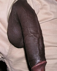 photo-thumb
