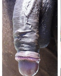 photo-thumb