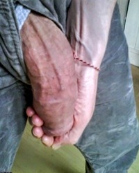 photo-thumb