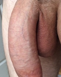 photo-thumb