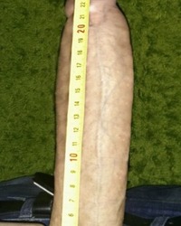 photo-thumb