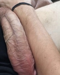 photo-thumb