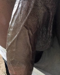 photo-thumb