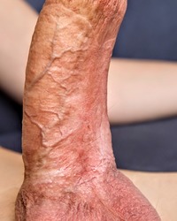 photo-thumb