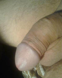 photo-thumb