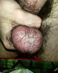 photo-thumb