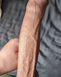 photo-thumb