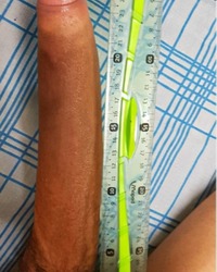 photo-thumb