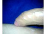 Musclemark Foreskin