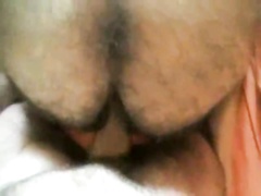 When Hairy Met Hairy