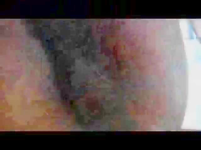 Thumb 20