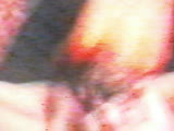 Thumb 6