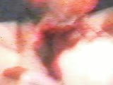 Thumb 8