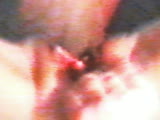 Thumb 9