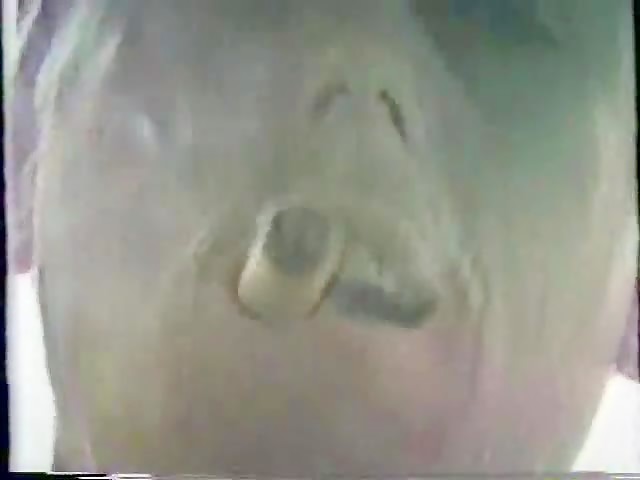 Thumb 8