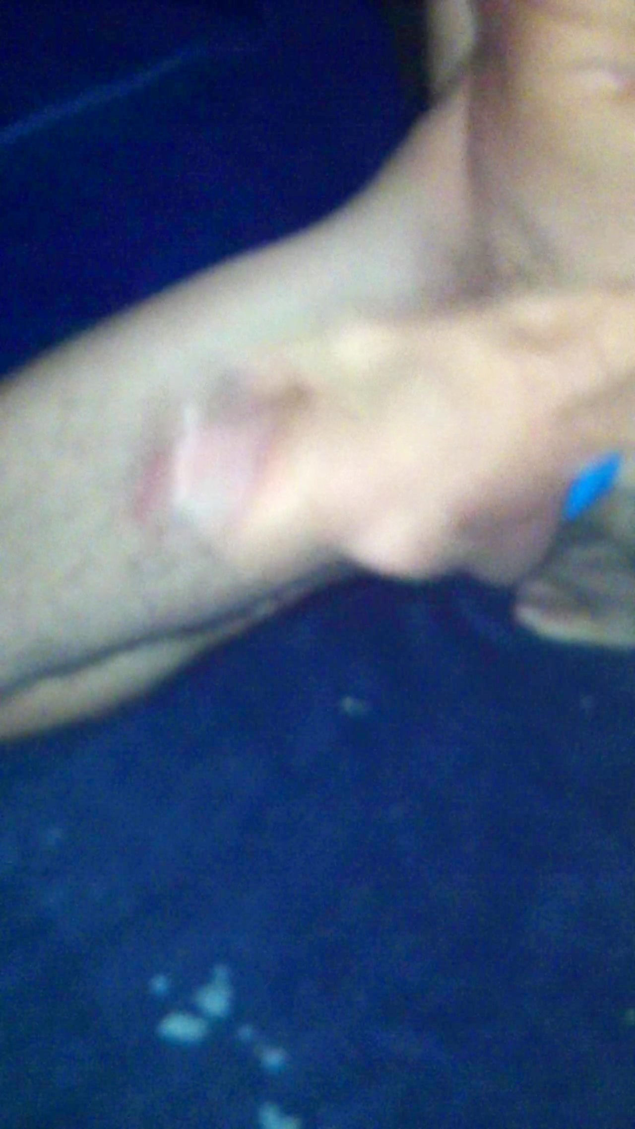 Thumb 14