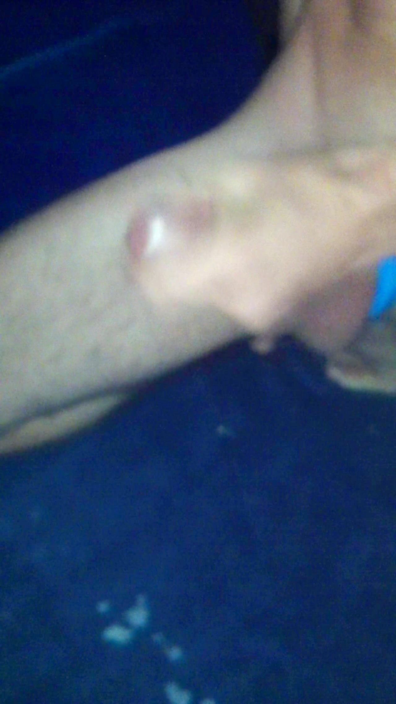 Thumb 15
