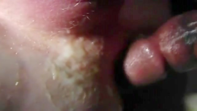 Thumb 20