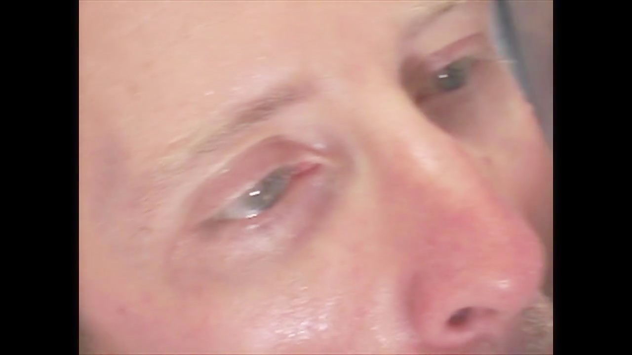 Thumb 20