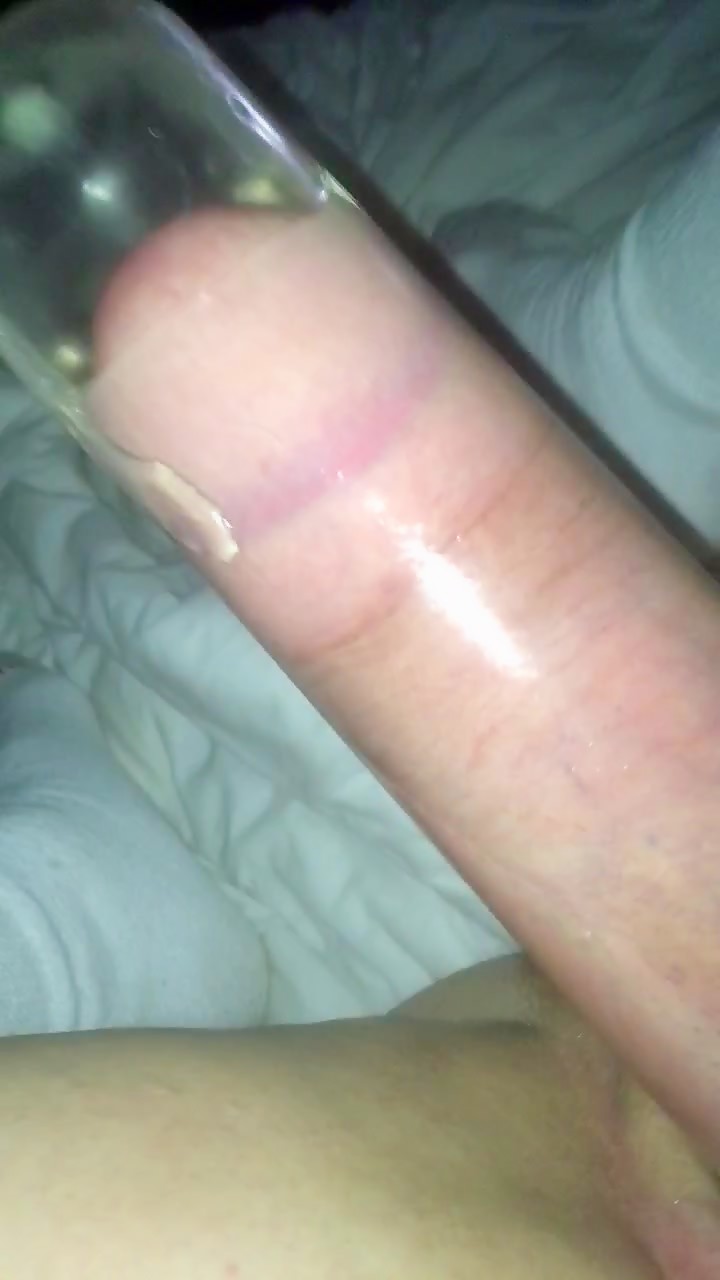Thumb 20