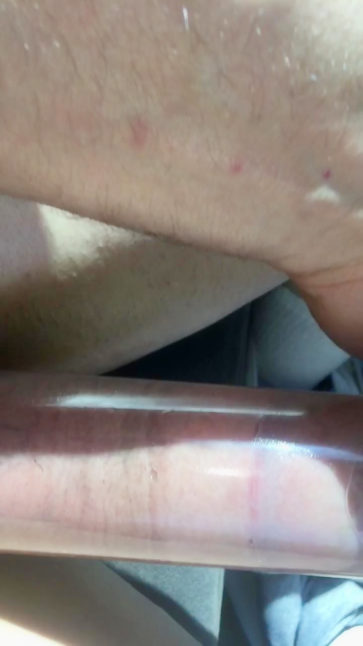 Thumb 6