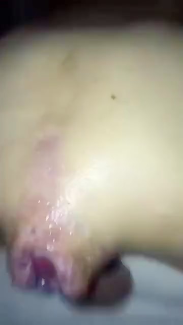 Thumb 11