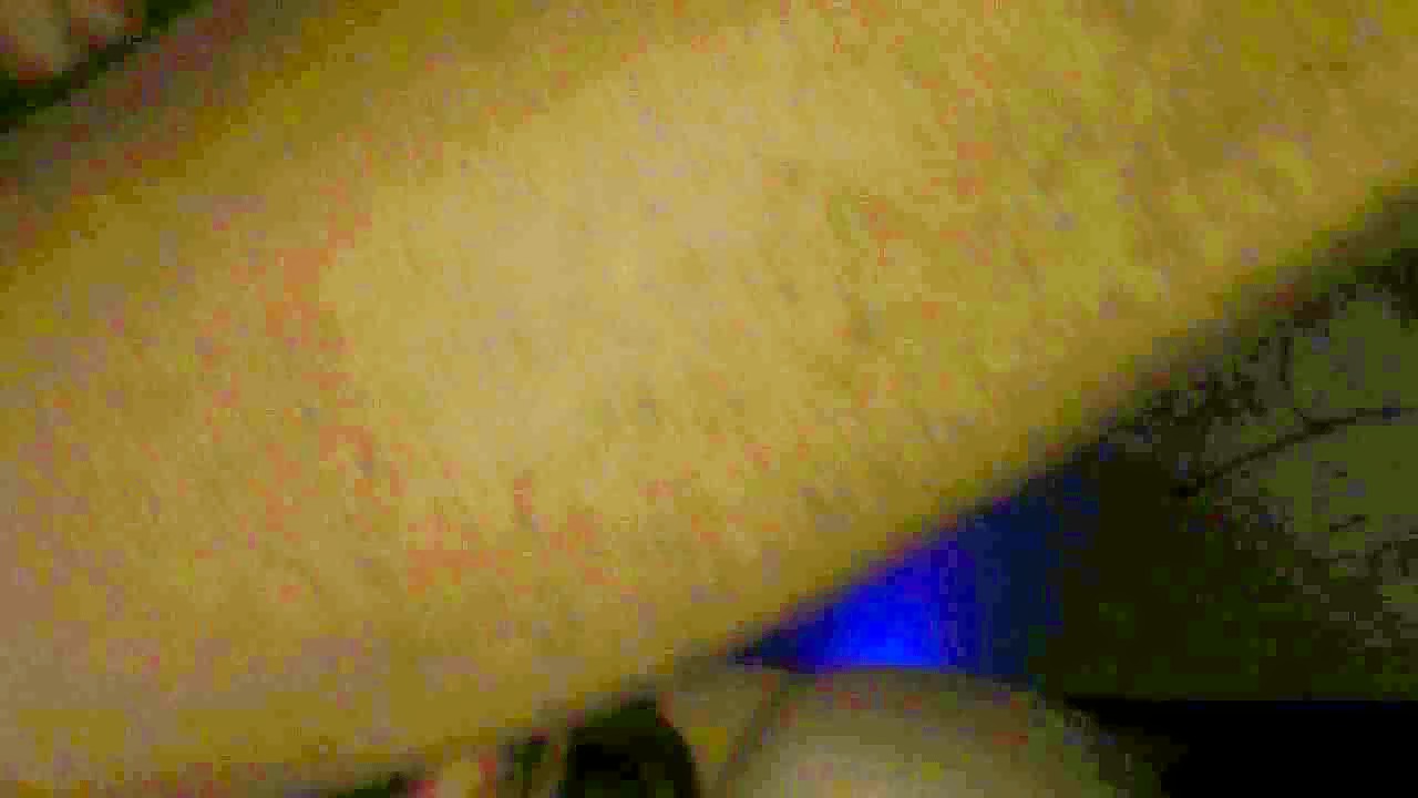 Thumb 20