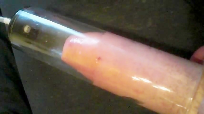 Thumb 13